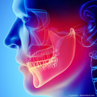 Kiefergelenk-Behandlung bei Zähneknirschen und Kiefergelenkknacken